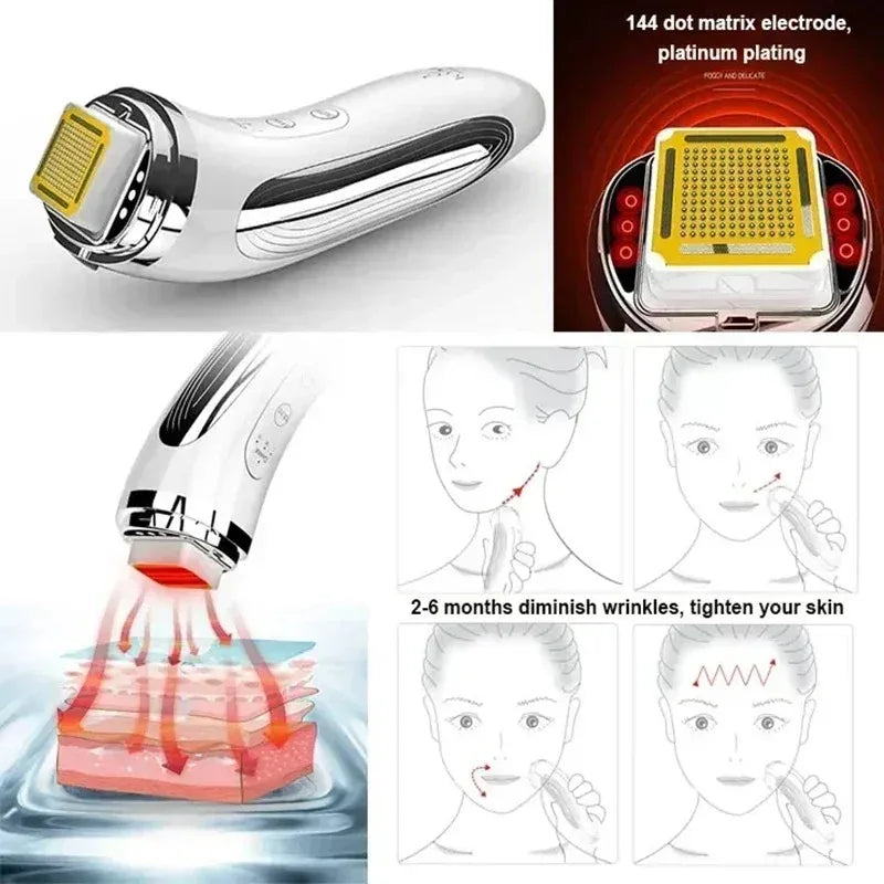RF Skin Tightening Device
