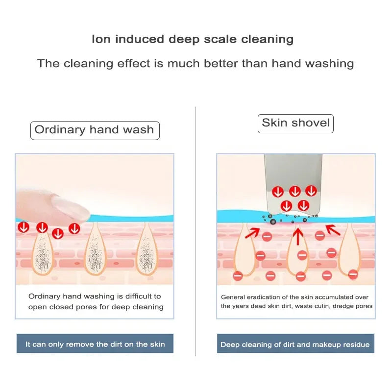 Diagram comparing ion-induced deep scale cleaning to ordinary hand washing and skin shovel use.