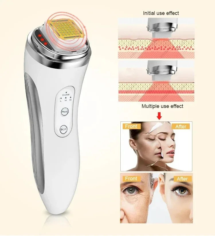 RF Skin Tightening Device